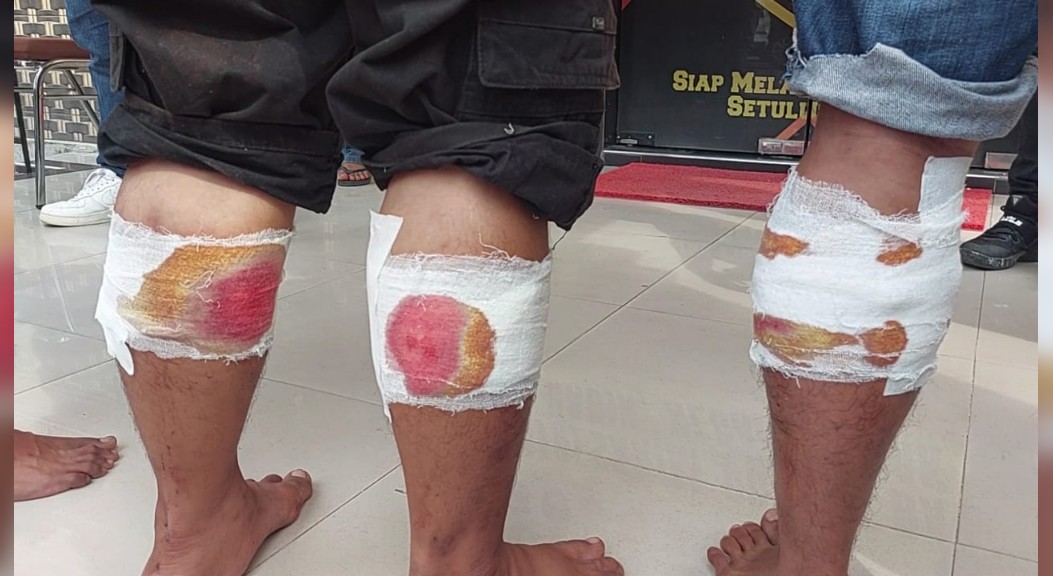 Polisi Tembak 2 dari 3 Tersangka Curat