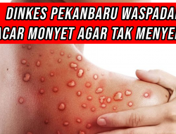 Dinkes Pekanbaru Waspadai Cacar Monyet Agar Tak Menyebar