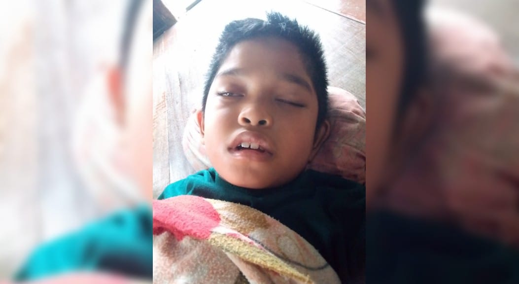 Rifki, Bocah Penderita Tumor Otak Harapkan Bantuan Dermawan untuk Biaya Operasi