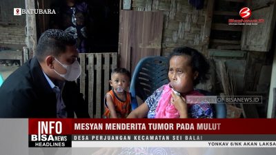 Mesyan Menderita Tumor pada Mulut, Desa Perjuangan Kecamatan Sei Balai