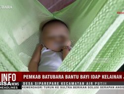 Pemkab Batubara Bantu Bayi Idap Kelainan Jantung