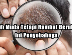 Masih Muda Tetapi Rambut Beruban? ini Penyebabnya