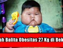 Kisah Balita Obesitas 27 Kg di Bekasi