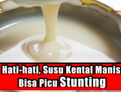 Hati-hati, Susu Kental Manis Bisa Picu Stunting