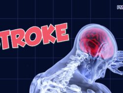 Hindari, Sejumlah Makanan Ini Bisa Tingkatkan Resiko Alami Stroke