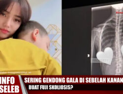 Sering Gendong Gala di Sebelah Kanan Buat Fuji Skoliosis