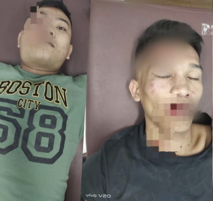 Dua Personel Batalion 126/KC Dikeroyok Puluhan Remaja di Kisaran