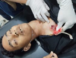 Polres Serdang Bedagai Tangani Kasus Penembakan Remaja di Perbaungan