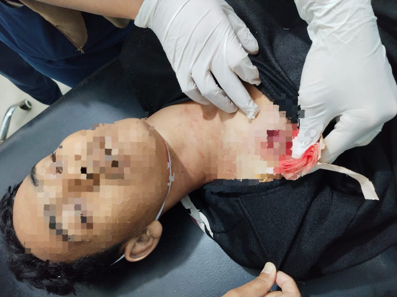 Polres Serdang Bedagai Tangani Kasus Penembakan Remaja di Perbaungan