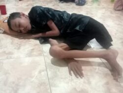 Setelah Kaki diamputasi kondisi Bocah Warga Deli Serdang memprihatinkan ,Orang Tua berharap Uluran tangan Bupati, Gubernur Hingga Presiden