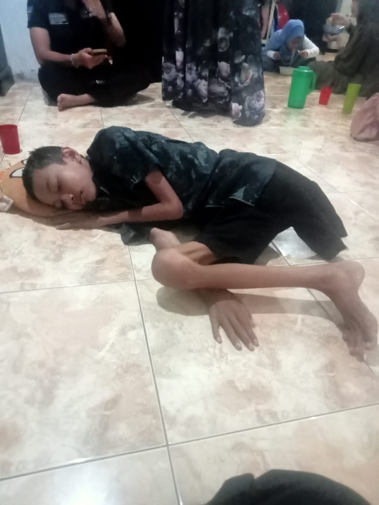 Setelah Kaki diamputasi kondisi Bocah Warga Deli Serdang memprihatinkan ,Orang Tua berharap Uluran tangan Bupati, Gubernur Hingga Presiden